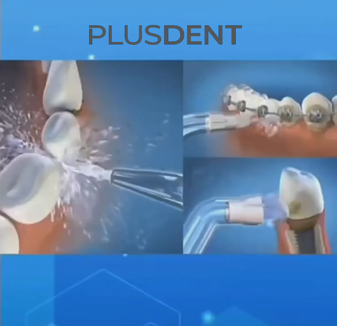 PLUSDENT IRRIGADOR DENTAL